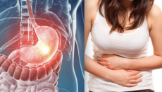 Nguyên nhân và dấu hiệu dạ dày chứa vi khuẩn HP dễ gây ung thư
