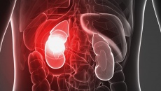 Video: Bệnh nhân chạy thận nhân tạo có thể sống được thêm bao lâu?