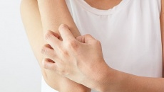 Làm dịu viêm da dị ứng với kem Eczestop