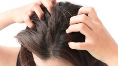 4 biện pháp tự nhiên trị ngứa da đầu hiệu quả tại nhà