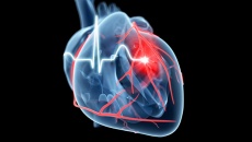 Tiền đái tháo đường cũng có thể làm tăng nguy cơ đau tim, đột quỵ