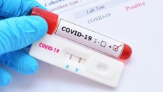 16 loại kit test nhanh COVID-19 được Bộ Y tế cấp phép và giá bán