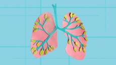 Giải pháp cải thiện sức khỏe trong quá trình điều trị ung thư phổi