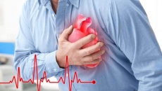 Đề phòng cơn đau thắt ngực do xơ vữa động mạch vành