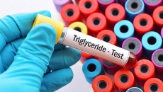 Triglyceride tăng cao nguy hiểm như thế nào? 