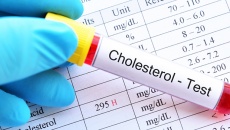 Những nguyên nhân gây ra tình trạng tăng cholesterol trong máu 