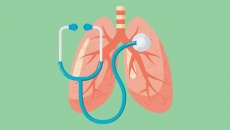 Các phương pháp điều trị ung thư phổi hiện nay