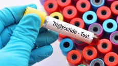 Các biện pháp giúp kiểm soát chỉ số triglyceride máu hiệu quả