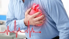 Rối loạn nhịp tim: Xử trí và phòng ngừa như thế nào?