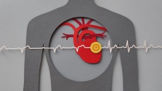 Đau tim thầm lặng nguy hiểm thế nào, có dấu hiệu cảnh báo không?