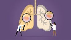 ung thư phổi và những thông tin hữu ích dành cho bạn!