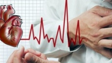 Thiếu máu cơ tim ảnh hưởng đến người bệnh, cách điều trị?