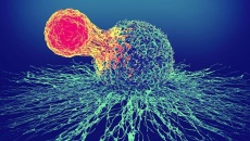 Liệu pháp tế bào CAR T: Tiên phong “chữa khỏi” ung thư máu