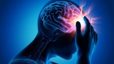 Thiếu máu lên não: Lạm dụng thuốc tăng tuần hoàn não, hoạt huyết – tai họa khôn lường