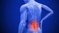 Hiểu về thoái hóa cột sống thắt lưng để cải thiện bệnh hiệu quả