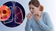Người bệnh ung thư phổi sống được bao lâu?