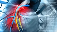 Các phương pháp chụp mạch vành chẩn đoán thiếu máu cơ tim và chi phí