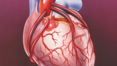 Bệnh mạch vành: Phương pháp bắc cầu động mạch vành có hiệu quả không?