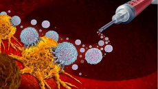 Dấu hiệu nhận biết bệnh nhân ung thư phổi không đáp ứng với liệu pháp miễn dịch