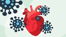 4 di chứng tim mạch hậu COVID-19 và cách khắc phục hiệu quả