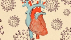 Di chứng tim mạch hậu COVID-19 do đâu, ai là người dễ mắc?