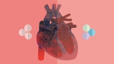Có phương pháp nào chữa khỏi dứt điểm nhịp tim nhanh không?
