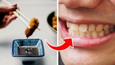 7 thực phẩm gây ố vàng răng bạn nên tránh
