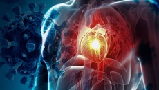 Rối loạn nhịp tim hậu COVID-19 có phục hồi được không?