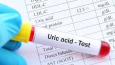 Tăng acid uric máu nguy hiểm như thế nào?