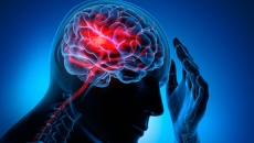 Hiểu về tắc mạch máu não để ngăn ngừa cơn đột quỵ