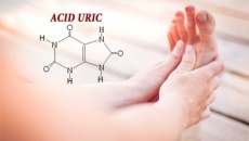 Mách bạn 6 cách giúp giảm acid uric tự nhiên ngay tại nhà