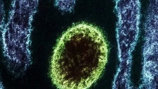 Virus Langya mới phát hiện ở Trung Quốc nguy hiểm thế nào?