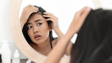 Khắc phục rụng tóc do stress