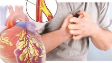 Tắc động mạch vành - Bệnh tim nguy hiểm có thể gặp ở mọi lứa tuổi