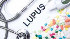Cải thiện lupus ban đỏ: Đâu là phương pháp hiệu quả?