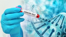 Tầm soát nhiều bệnh ung thư bằng một lần xét nghiệm: Những điều chưa chắc chắn
