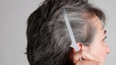 Những chất dinh dưỡng giúp làm chậm quá trình bạc tóc