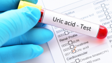 Cách giảm acid uric trong máu hiệu quả, an toàn