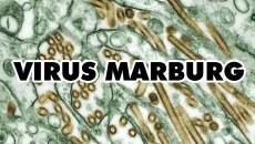 Bệnh do virus Marburg: Triệu chứng, nguyên nhân, điều trị thế nào?