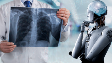 Trí tuệ nhân tạo giúp phát hiện ung thư phổi sớm?