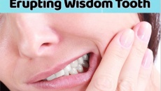 5 dấu hiệu bạn sắp mọc răng khôn