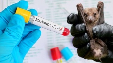 Virus Marburg: Những lần xuất hiện và nguy cơ xảy ra tại Việt Nam?