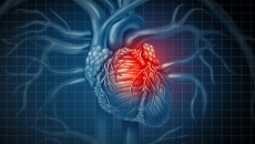Bị cầu cơ mạch vành kèm mỡ máu cao phải làm sao?