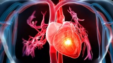Liệu pháp tế bào gốc giúp giảm nguy cơ đau tim, đột quỵ ở người suy tim nặng