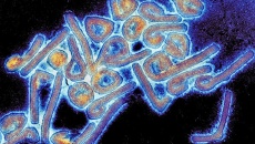 WHO cảnh báo virus Marburg đang lây lan nhanh ở nhiều quốc gia