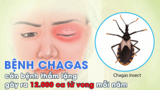 Bệnh Chagas: Căn bệnh thầm lặng gây ra 12.000 ca tử vong mỗi năm