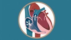 Chuyên gia giải đáp: Có mấy mức độ hở van tim?