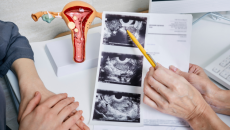 Những điều cần biết về bệnh lạc nội mạc tử cung