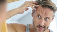 Bỏ túi 8 mẹo chăm sóc da đầu nhờn cho nam giới