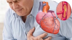 Bị thiếu máu cơ tim có thể sống được bao lâu? 